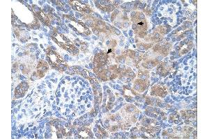 SILV antibody was used for immunohistochemistry at a concentration of 4-8 ug/ml. (Melanoma gp100 抗体)