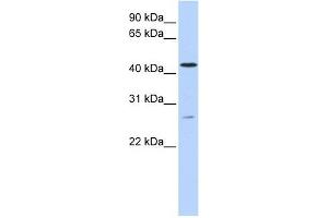 ACBD5 antibody used at 1 ug/ml to detect target protein. (ACBD5 抗体  (C-Term))