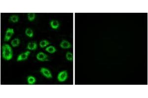 Immunofluorescence analysis of A549 cells, using ATP5D Antibody. (ATP5F1D 抗体  (AA 61-110))