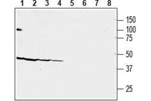Western blot analysis of human MOLT-4 acute lymphoblastic leukemia (lanes 1 and 5), human CAKI-1 renal cell carcinoma (lanes 2 and 6), human MEG-O1 megakaryoblastic leukemia (lanes 3 and 7) and human COLO-205 colon adenocarcinoma (lanes 4 and 8) cell line lysates: - 1-4. (CRHR2 抗体  (Extracellular))