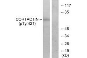 Western blot analysis of extracts from HeLa cells treated with H2O2, using Cortactin (Phospho-Tyr421) Antibody. (Cortactin 抗体  (pTyr421))