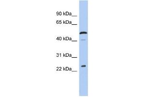 WB Suggested Anti-C1orf190 Antibody Titration: 0. (Chromosome 1 Open Reading Frame 190 (C1orf190) (Middle Region) 抗体)