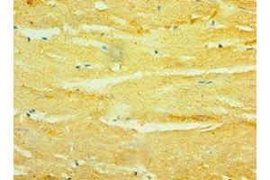 Immunohistochemistry of paraffin-embedded human heart tissue using ABIN7154912 at dilution of 1:100 (HSPB2 抗体  (AA 1-182))