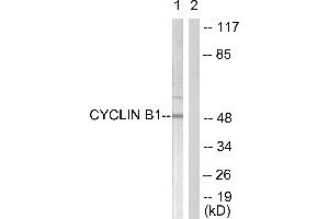 Western blot analysis of extracts from HeLa cells, treated with serum (10%, 15min), using Cyclin B1 (Ab-126) antibody (#BOO68, Line 1 and 2).
