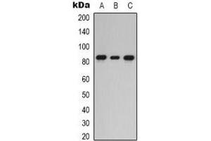 Western blot analysis of PKC epsilon expression in HEK293T (A), Hela (B), HepG2 (C) whole cell lysates. (PKC epsilon 抗体  (C-Term))