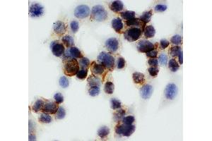 Anti-Annexin V antibody, ICC ICC: HCT116 Cell (Annexin V 抗体  (Middle Region))