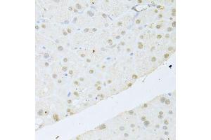 Immunohistochemistry (Paraffin-embedded Sections) (IHC (p)) image for anti-V-Akt Murine Thymoma Viral Oncogene Homolog 1 (AKT1) (C-Term) antibody (ABIN6136733)