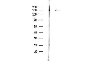 Western blot analysis of lysates from Mouse lung, using Phospho-RON (Ser1394) Antibody at 1/1000 dilution.