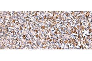Immunohistochemistry of paraffin-embedded Human tonsil tissue using IP6K1 Polyclonal Antibody at dilution of 1:40(x200) (IP6K1 抗体)