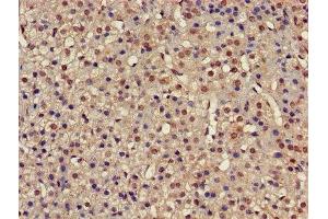 Immunohistochemistry (IHC) image for anti-Proteasome (Prosome, Macropain) 26S Subunit, ATPase, 4 (PSMC4) (AA 112-181), (Regulatory Subunit 6B) antibody (ABIN7142234)