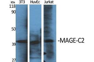 Western Blot (WB) analysis of specific cells using MAGE-C2 Polyclonal Antibody. (MAGEC2 抗体  (Internal Region))