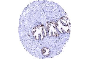 Normal prostate with strong granular perinuclear cytoplasmic prostein staining of luminal cells (Recombinant SLC45A3 抗体  (N-Term))