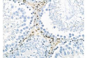 ABIN6257815 and ABIN6275703 at 1/100 staining Rat testis tissue by IHC-P.