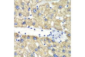 Immunohistochemistry of paraffin-embedded human liver injury using ABAT antibody (ABIN1876487) at dilution of 1:100 (40x lens). (ABAT 抗体)