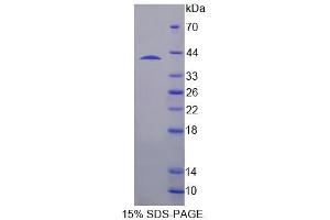 SDS-PAGE analysis of Human SH3BP2 Protein. (SH3BP2 蛋白)