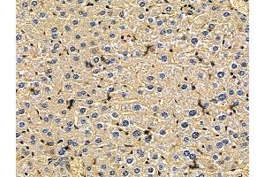 ABIN7096690 and ABIN7100755 at 1/100 staining mouse liver tissue by IHC-P. (USH2A 抗体)