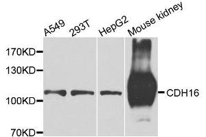 Western blot analysis of extracts of various cell lines, using CDH16 antibody. (Cadherin-16 抗体  (AA 19-230))
