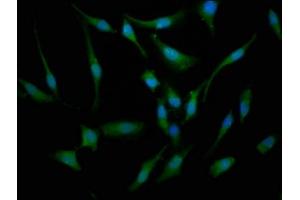 Immunofluorescence staining of Hela cells with ABIN7145246 at 1:133, counter-stained with DAPI. (BBS7 抗体  (AA 289-393))