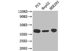 Western Blot Positive WB detected in: PC-3 whole cell lysate, HepG2 whole cell lysate, HEK293 whole cell lysate All lanes: C5AR1 antibody at 3 μg/mL Secondary Goat polyclonal to rabbit IgG at 1/50000 dilution Predicted band size: 40 kDa Observed band size: 40 kDa (C5AR1 抗体  (AA 1-36))