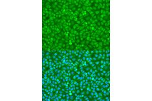 Immunofluorescence analysis of U2OS cells using FOXO3 antibody. (FOXO3 抗体  (AA 394-672))