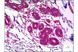 Immunohistochemistry (IHC) image for anti-Mitogen-Activated Protein Kinase 8 (MAPK8) antibody (ABIN953306)