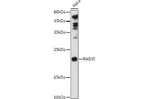 Western blot analysis of extracts of HeLa cells, using R antibody (ABIN6133143, ABIN6146576, ABIN6146578 and ABIN6224057) at 1:1000 dilution. (RAB35 抗体  (AA 1-201))