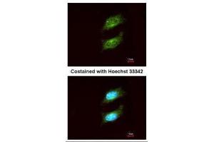 ICC/IF Image Immunofluorescence analysis of methanol-fixed HeLa, using PKA alpha, antibody at 1:200 dilution. (PRKACA 抗体  (Center))