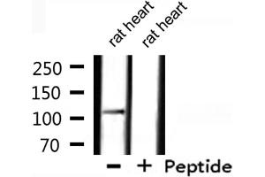 Western blot analysis of extracts from rat heart, using XPF Antibody. (ERCC4 抗体  (C-Term))