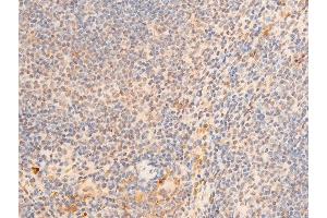 ABIN6267273 at 1/100 staining mouse spleen tissue sections by IHC-P.