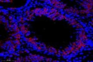 Immunofluorescent analysis of paraformaldehyde-fixed rat testis using,TTC12 (ABIN7075869) at dilution of 1: 1000 (TTC12 抗体)