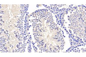 Detection of APP in Mouse Testis Tissue using Polyclonal Antibody to Amyloid Precursor Protein (APP) (APP 抗体  (AA 18-286))