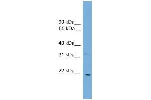 WB Suggested Anti-CTF1  Antibody Titration: 0. (Cardiotrophin 1 抗体  (N-Term))