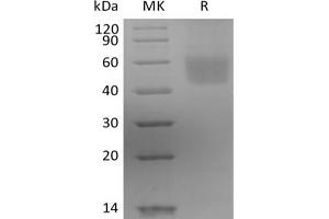 Western Blotting (WB) image for Interleukin 3 Receptor, alpha (IL3RA) protein (His tag) (ABIN7319927)
