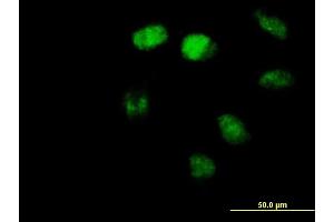 Immunofluorescence of purified MaxPab antibody to ZBTB3 on HeLa cell. (ZBTB3 抗体  (AA 1-574))