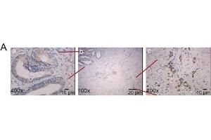 The correlation between XPNPEP2 and metastasis. (XPNPEP2 抗体  (Center))