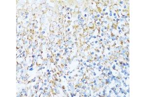 Immunohistochemistry of paraffin-embedded Human tonsil using NDUFA5 Polyclonal Antibody at dilution of 1:100 (40x lens). (NDUFA5 抗体)