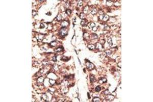 Image no. 1 for anti-Melanoma Antigen Family A, 11 (MAGEA11) (N-Term) antibody (ABIN358642) (MAGEA11 抗体  (N-Term))