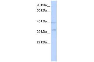 WB Suggested Anti-SIRT5 Antibody Titration:  0. (SIRT5 抗体  (Middle Region))