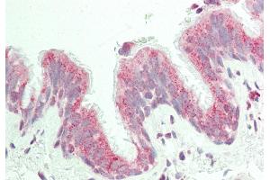 Rabbit Anti-KIAA0317 antibody  Formalin Fixed Paraffin Embedded Tissue: Human Lung, Respiratory Epithelium Primary antibody Concentration: 1:100 Secondary Antibody: Donkey anti-Rabbit-Cy3 Secondary Antibody Concentration: 1:200 Magnification: 20x Exposure Time: 0. (AREL1 抗体  (N-Term))