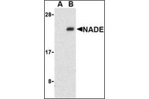 Western blot analysis of NADE in Human brain cell lysates with this product at 1 μg/ml in the presence (A) or absence (B) of blocking peptide. (Nerve Growth Factor Receptor (TNFRSF16) Associated Protein 1 (NGFRAP1) (Middle Region) 抗体)