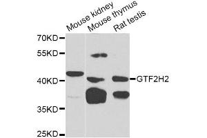 Western blot analysis of extracts of various cell lines, using GTF2H2 Antibody (ABIN5975366) at 1/1000 dilution. (GTF2H2 抗体)