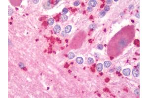 Anti-PPP3CA / CCN1 / Calcineurin A antibody IHC staining of human brain, cerebellum.