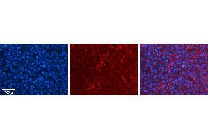 Rabbit Anti-MLX Antibody   Formalin Fixed Paraffin Embedded Tissue: Human Liver Tissue Observed Staining: Cytoplasm in endothelial cells in sinusoids Primary Antibody Concentration: N/A Other Working Concentrations: 1:600 Secondary Antibody: Donkey anti-Rabbit-Cy3 Secondary Antibody Concentration: 1:200 Magnification: 20X Exposure Time: 0.