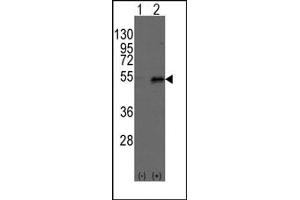 Image no. 1 for anti-Dystrobrevin Binding Protein 1 (DTNBP1) (C-Term) antibody (ABIN357846) (DTNBP1 抗体  (C-Term))