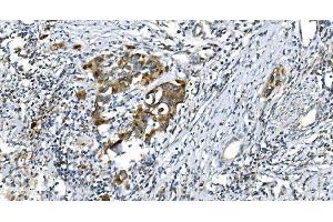 IHC analysis of DRP1/DNM1L using anti-DRP1/DNM1L antibody (ABIN7602180). (Dynamin 1-Like 抗体  (AA 618-736))