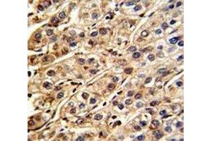 Immunohistochemistry (IHC) image for anti-Protein tyrosine Phosphatase, Non-Receptor Type 11 (PTPN11) (AA 526-551) antibody (ABIN3032394)