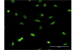 Immunofluorescence of monoclonal antibody to CBX1 on HeLa cell. (CBX1 抗体  (AA 2-99))