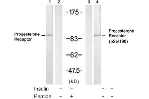 Image no. 2 for anti-Progesterone Receptor (PGR) (Ser190) antibody (ABIN319297) (Progesterone Receptor 抗体  (Ser190))