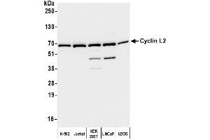 anti-Cyclin L2 (CCNL2) (AA 470-520) antibody