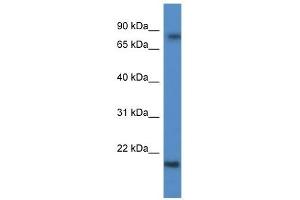 Western Blot showing KRTAP1-5 antibody used at a concentration of 1 ug/ml against Fetal Brain Lysate (KRTAP1-5 抗体  (C-Term))